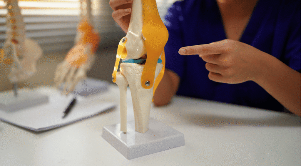 A musculoskeletal specialist using a knee model to explain the causes of graft failure during post ACL surgery physiotherapy in Indore to a patient from Nipania.
