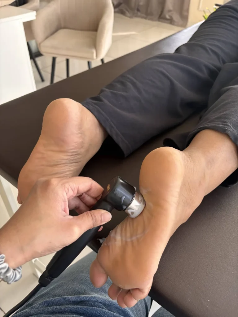Ultrasound Therapy in Indore provided at Dr Manisha Physiotherapy Clinic to a patient with plantarfascitis.